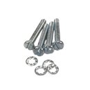 Speedometer fixing kit Series 1 (stainless) -E27-